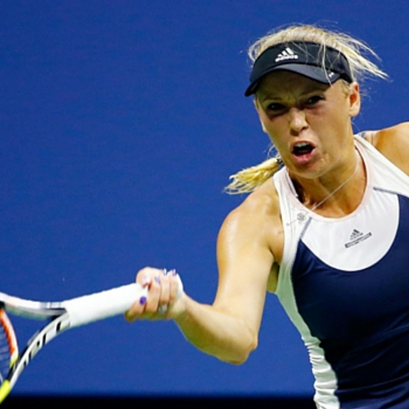 Wozniacki takes 2nd set episode artwork
