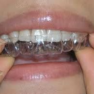 Orthodonticslasvegas