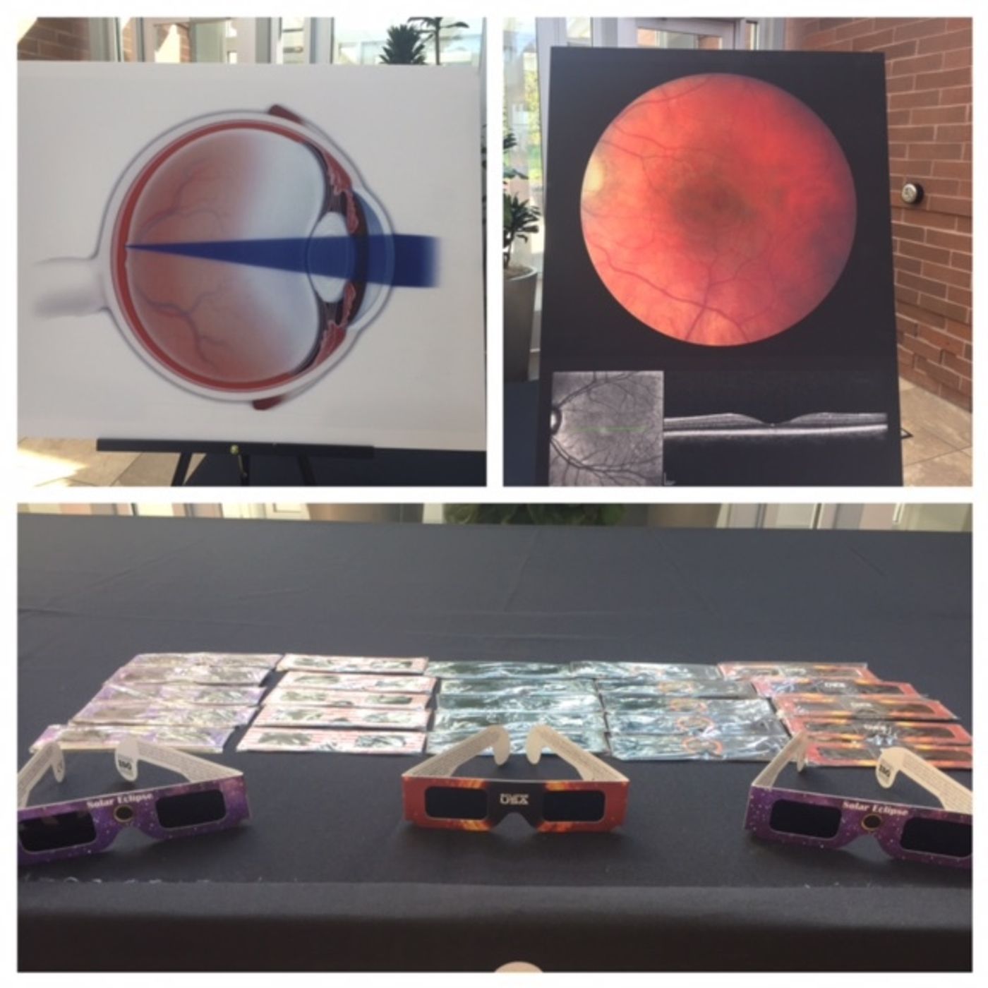 Eye doctors, victim warn of solar eclipse damage episode artwork