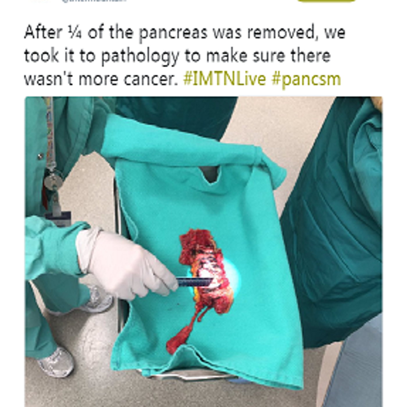 Intermountain live-tweets cancer surgery episode artwork
