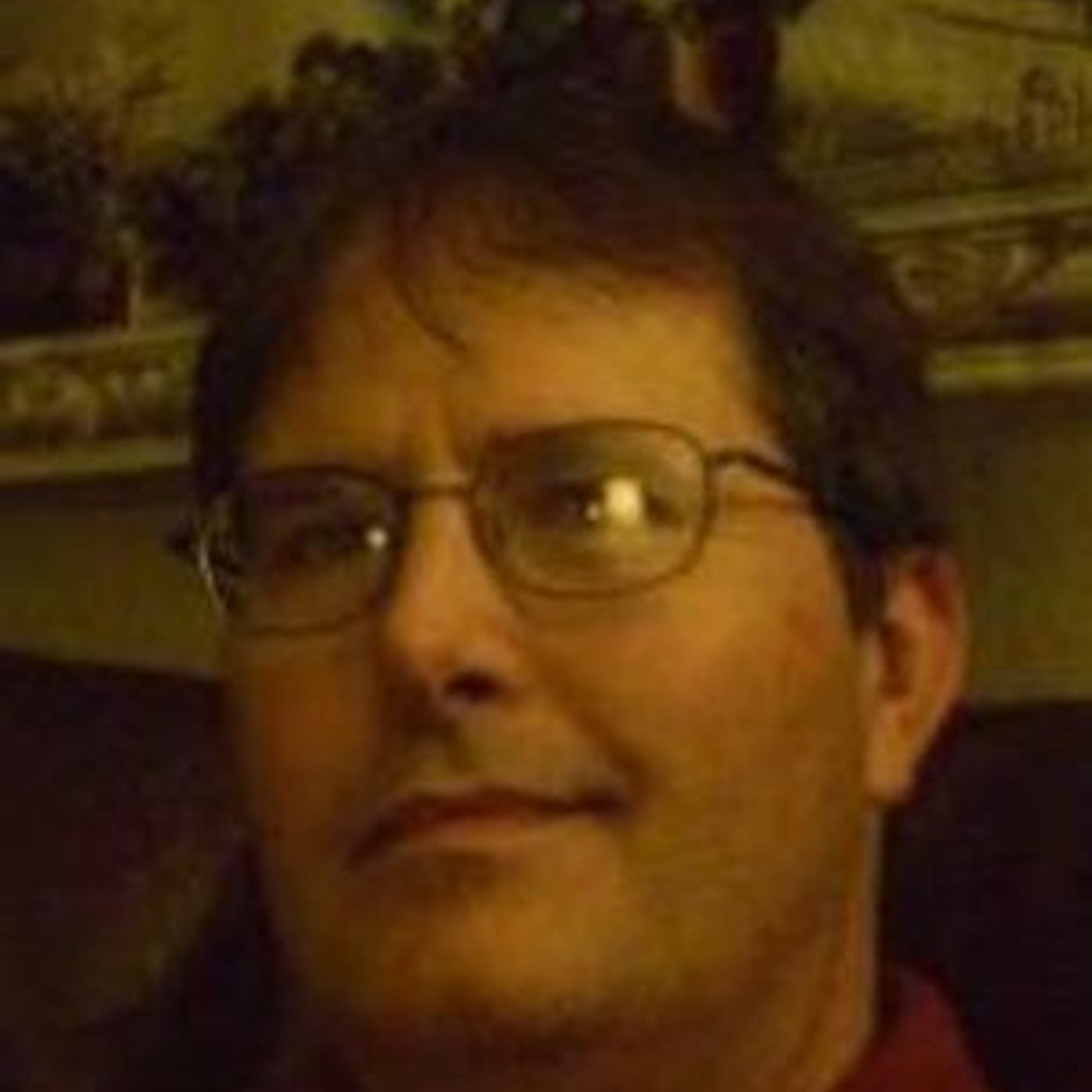 Alien Implants: Patient 17 - Steve Colbern