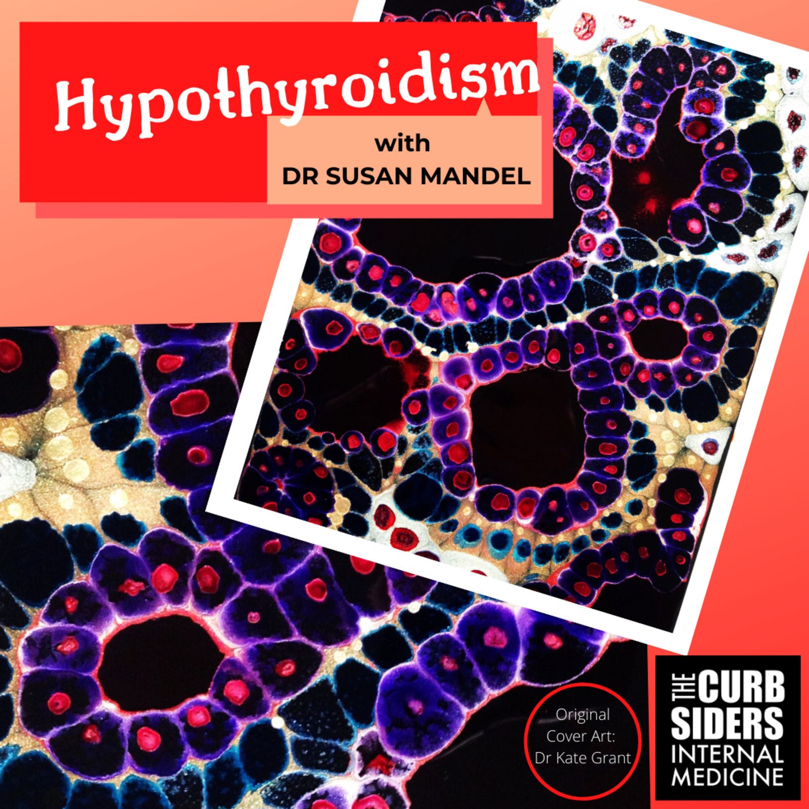 #208 Hypothyroidism Master Class with Susan Mandel MD - How to dominate the diagnosis and management