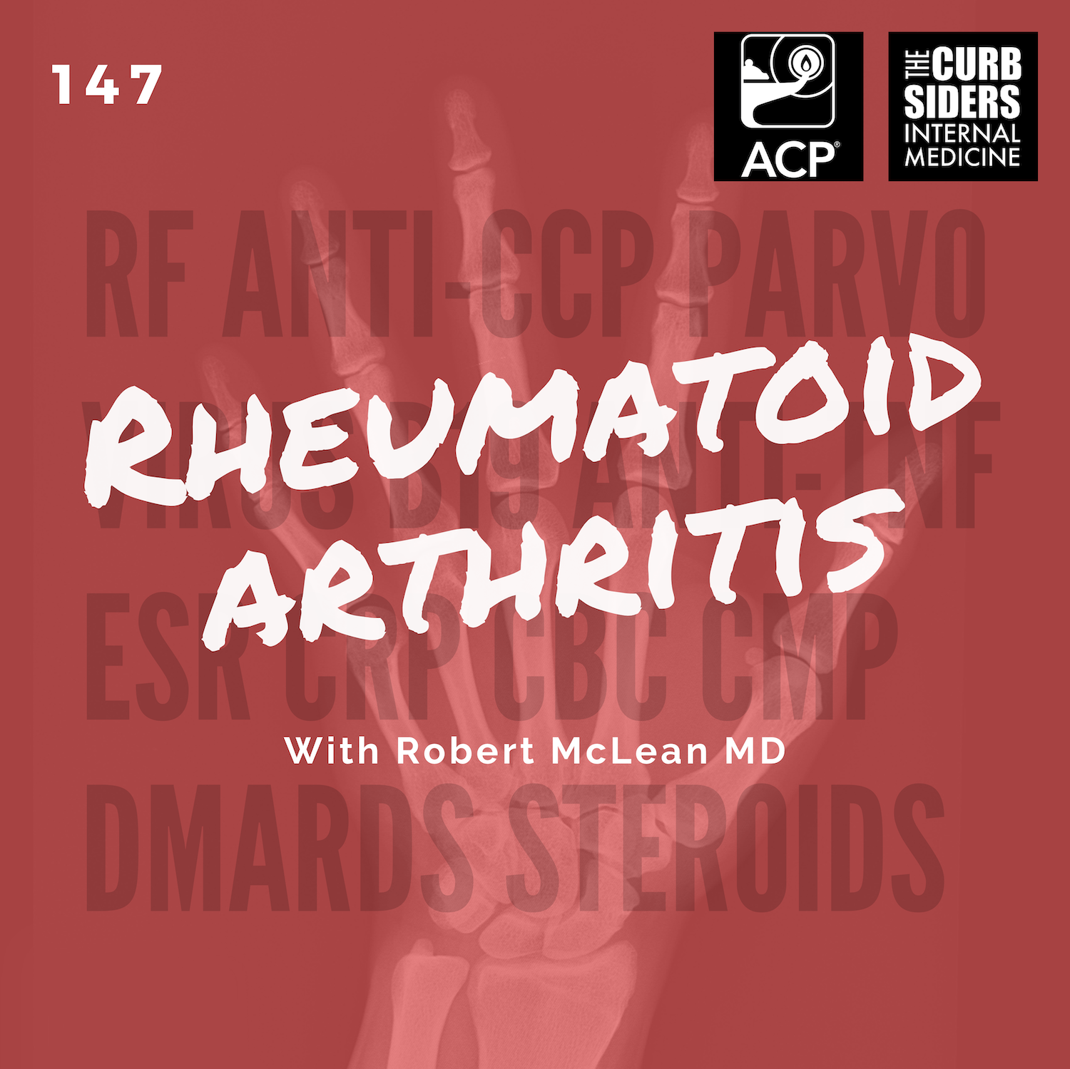 #147 Rheumatoid Arthritis for the Internist