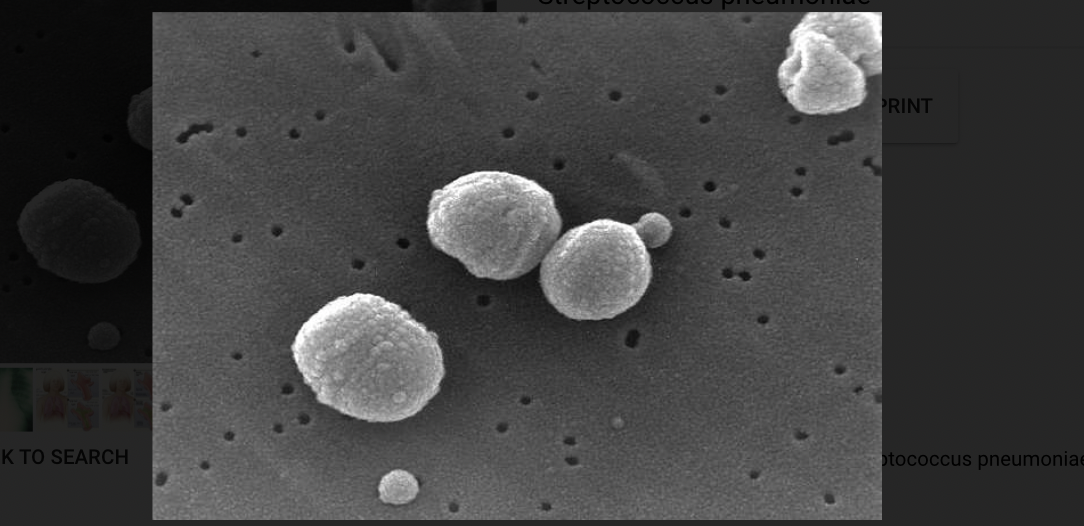 Стрептококус пневмония. Streptococcus pneumoniae микропрепарат.