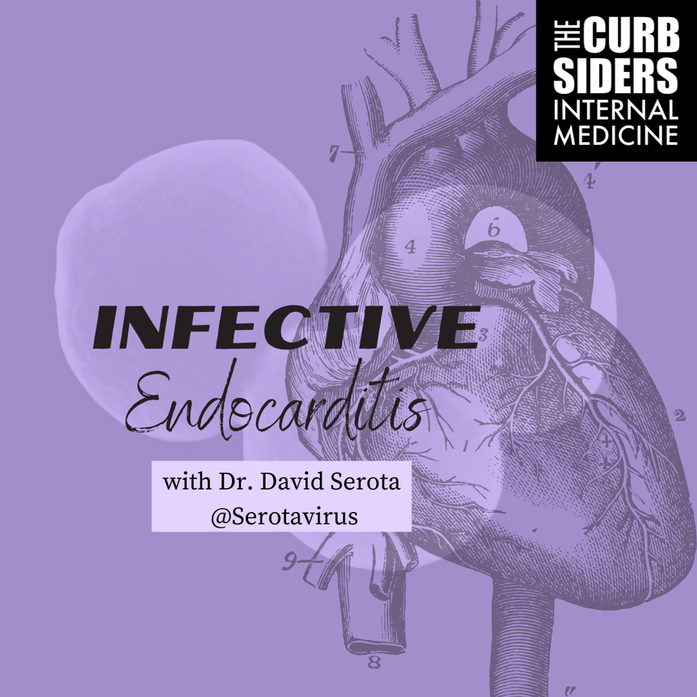 #312 Infective Endocarditis