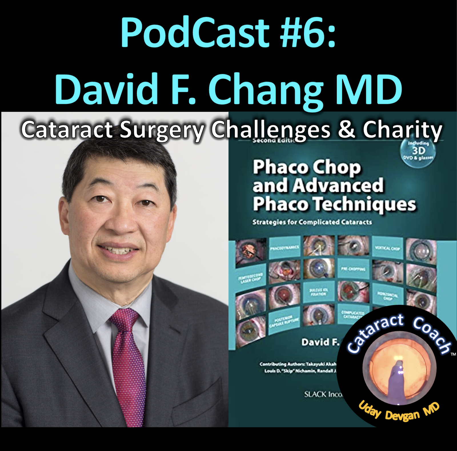 6: CataractCoach PodCast 6: David F. Chang MD