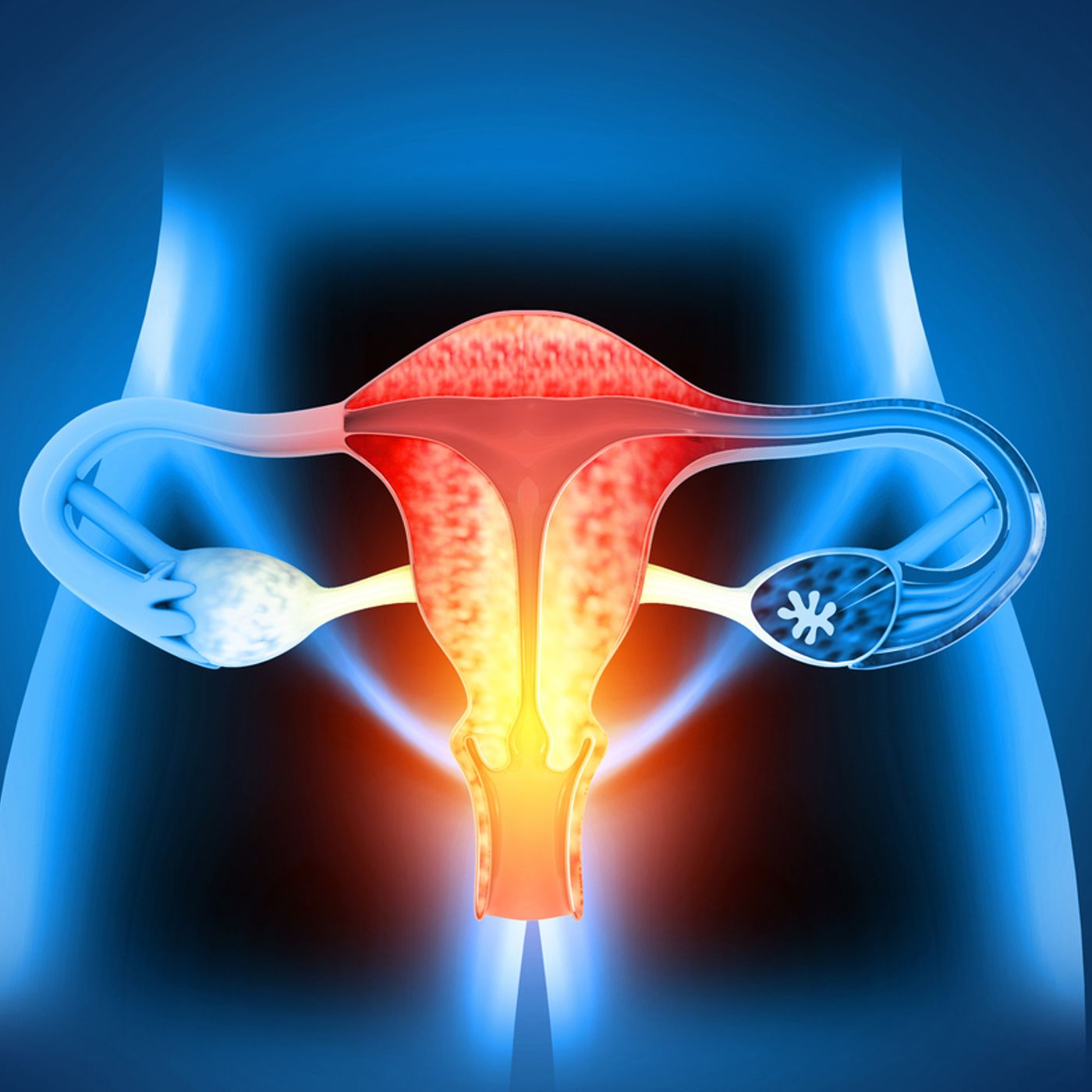 Early diagnosis of cervical and endometrial cancer podcast