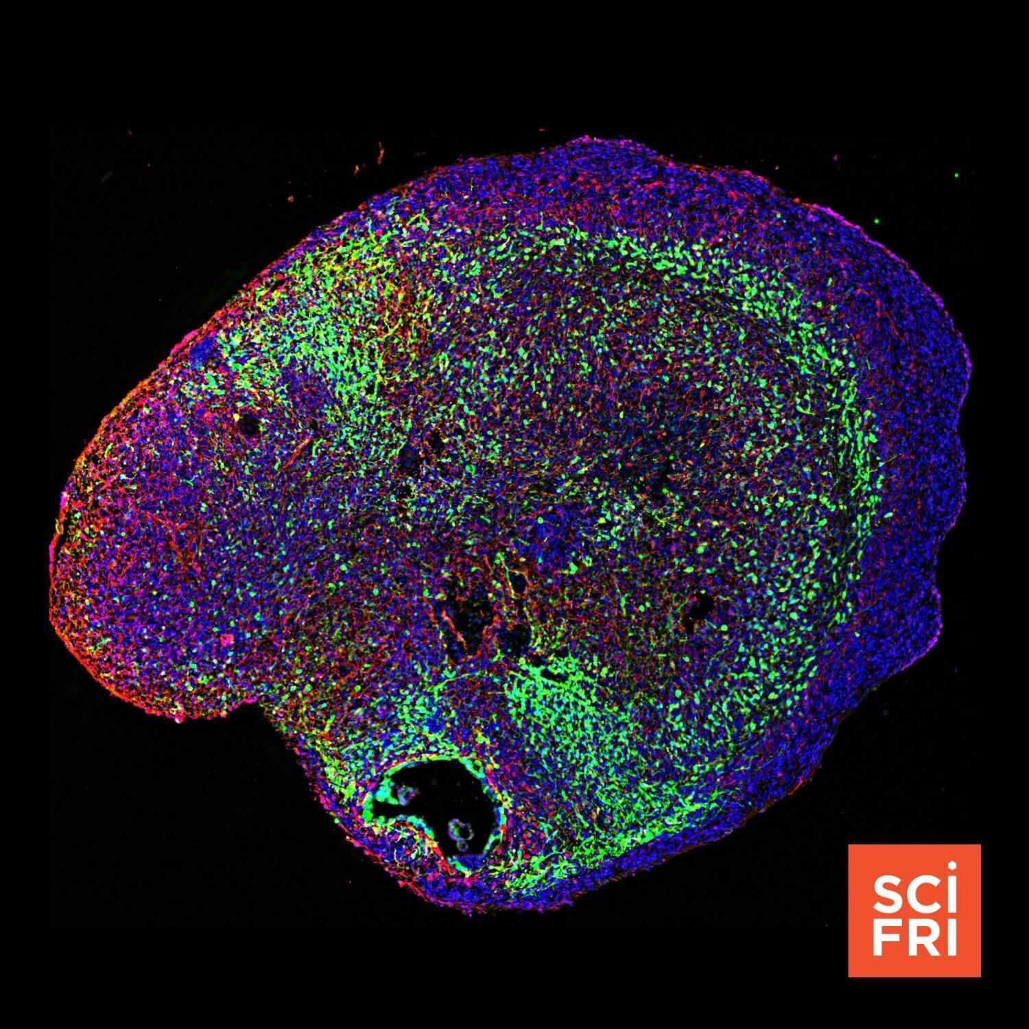 685: Brain ‘Organoids’: Lab-Grown Cell Clusters Model Brain Functions