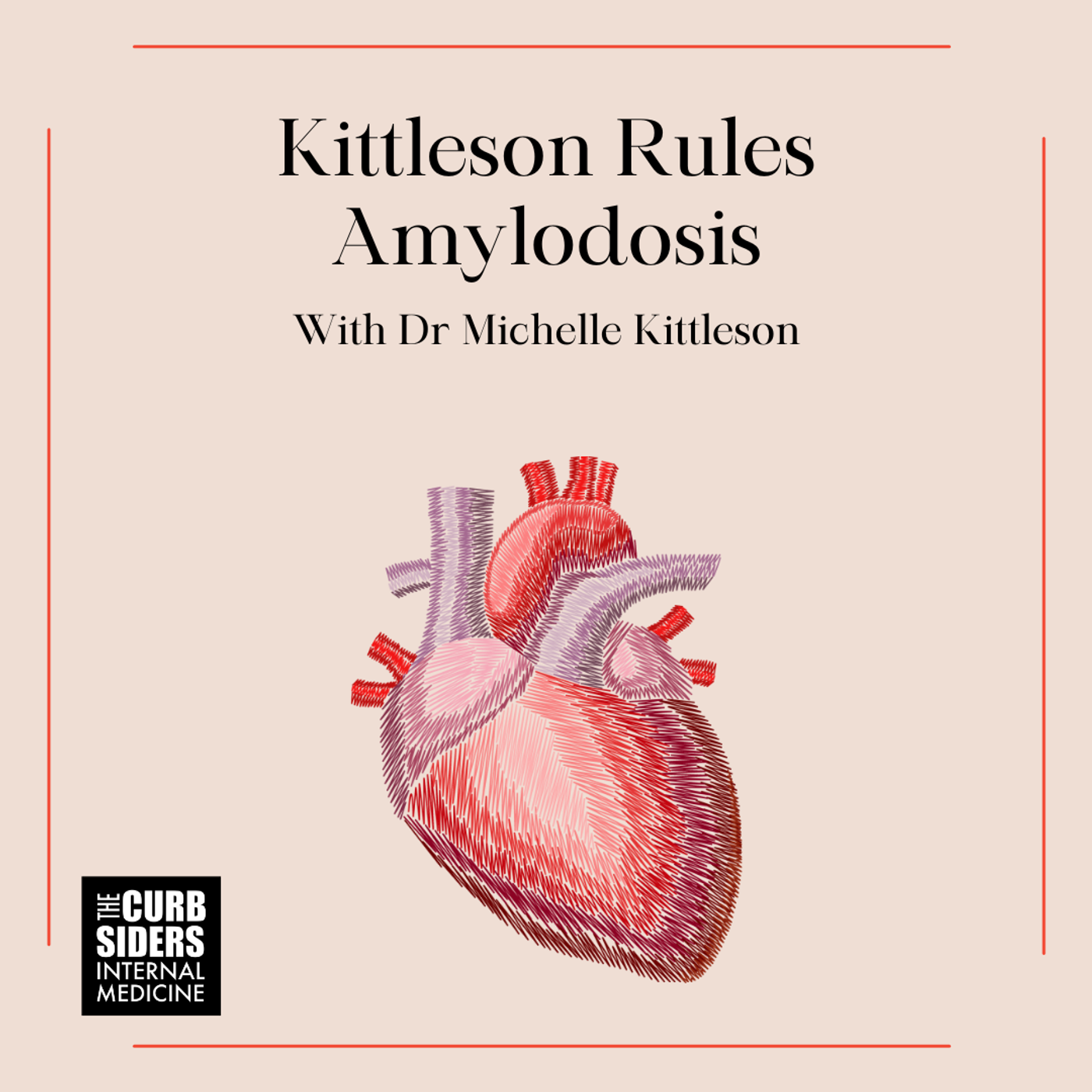 #427 Kittleson Rules Cardiac Amyloidosis