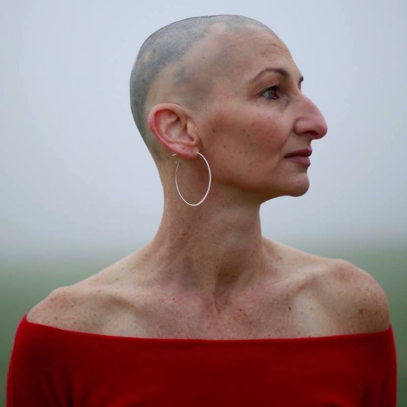46: Bald & Beautiful: Redefining Body Image After Hair Loss