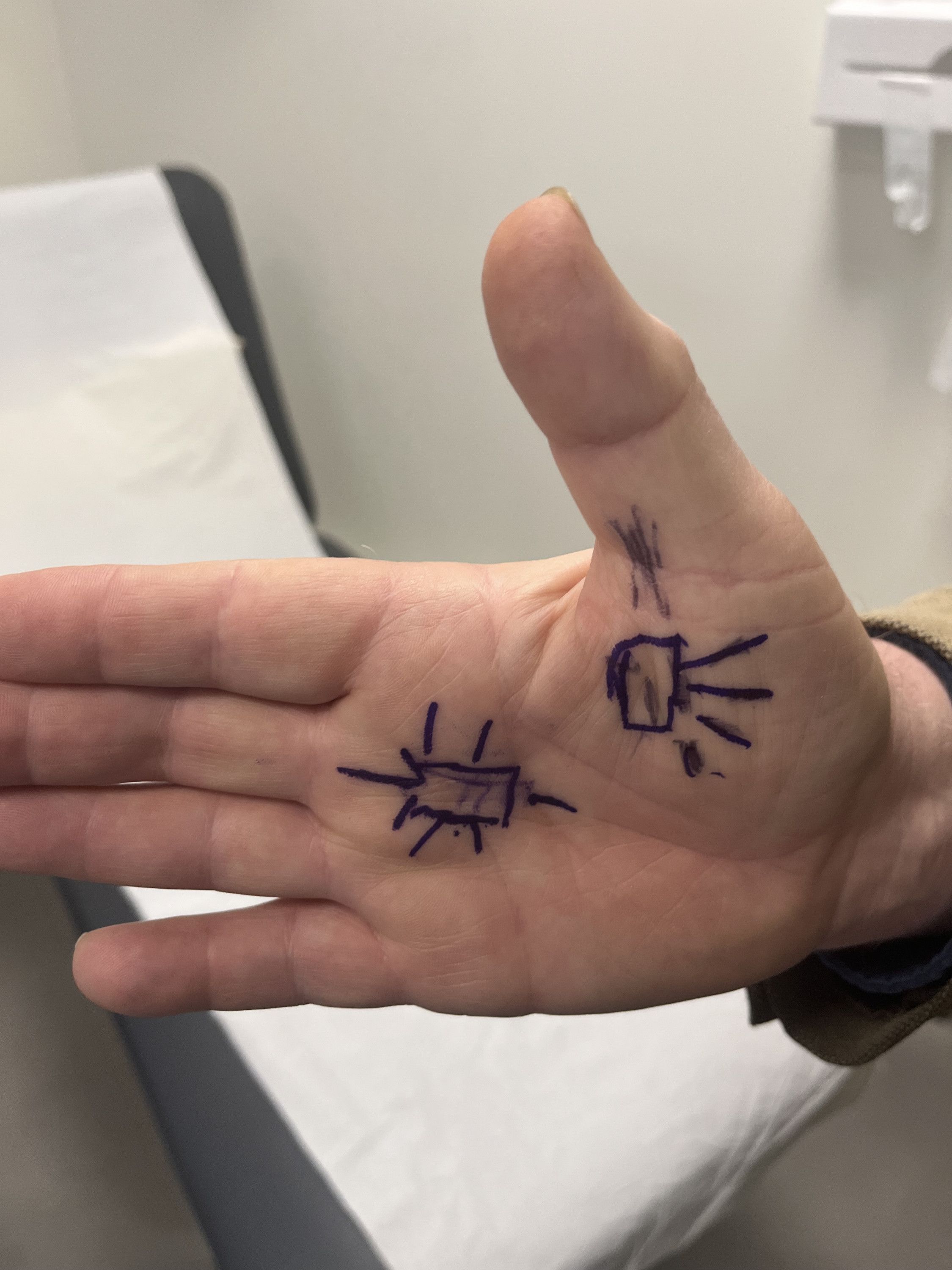 ENDURING PAIN - Paul O’Mahony #Marpodpomo