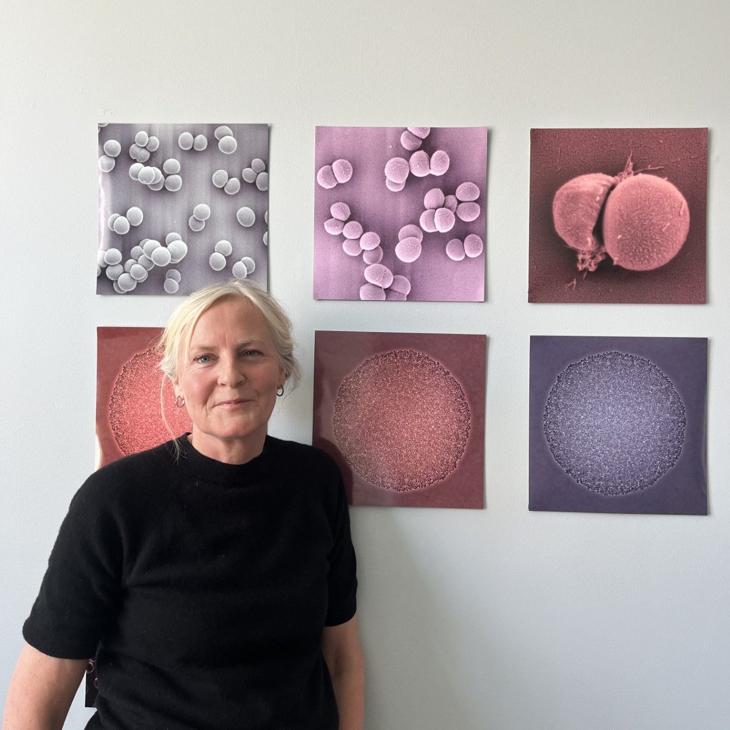 S5 Ep6: Hvad sker der, når antibiotika dræber bakterier? S5 Ep6: Hvad sker der, når antibiotika dræber bakterier?