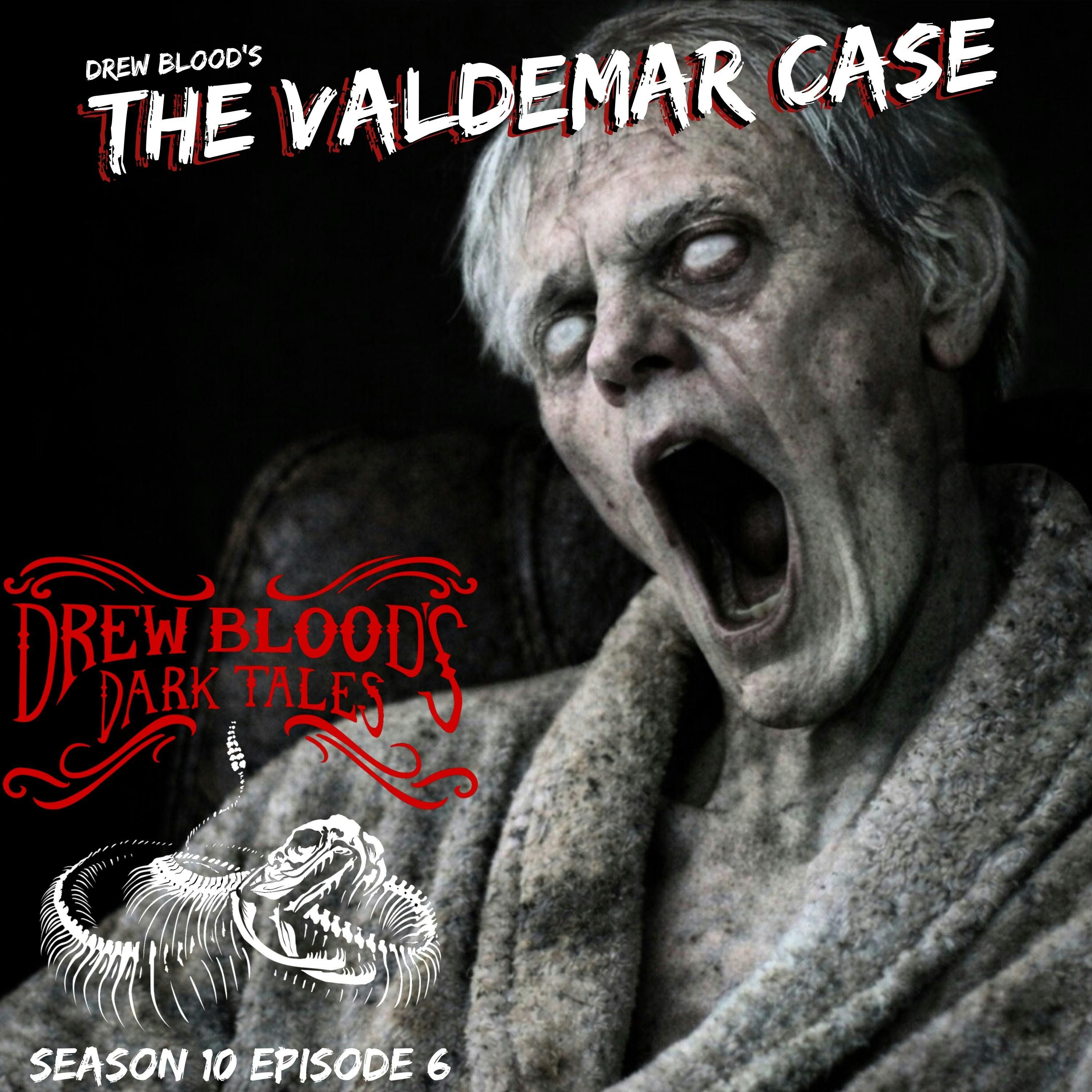 S10E06 - "The Valdemar Case" - Drew Blood