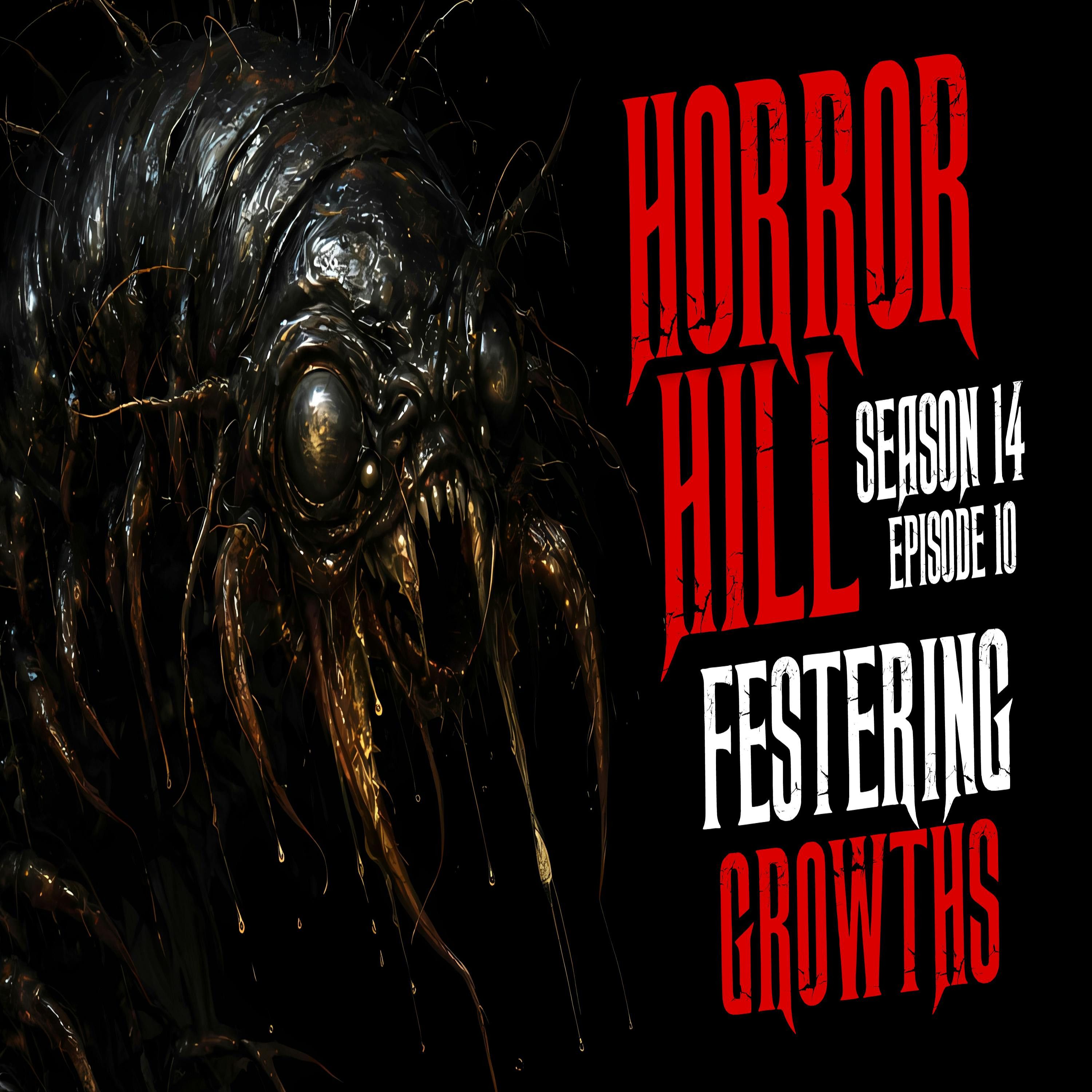 S14E10 - "Festering Growths" - Horror Hill