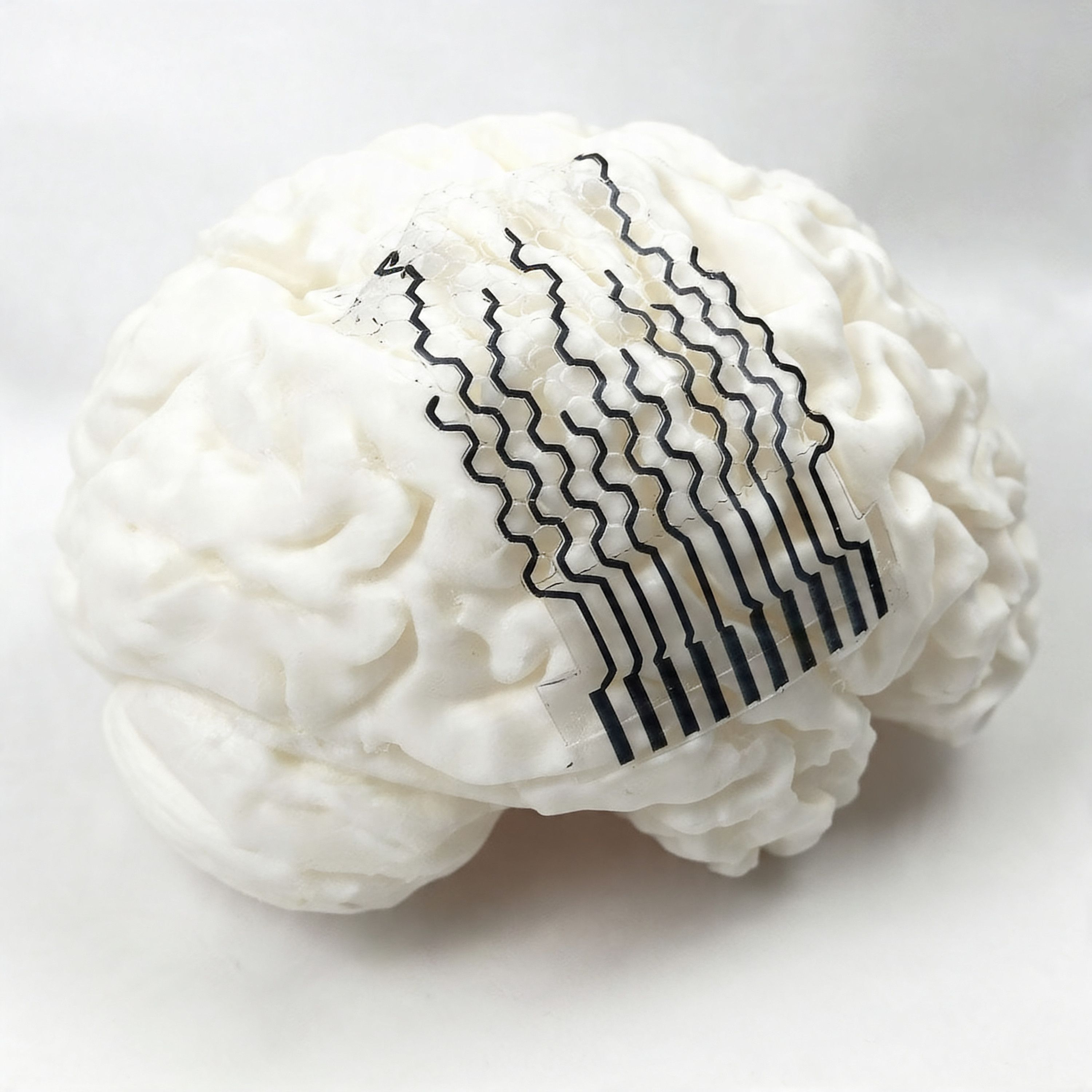 589: Podcast IA - Cómo sensores cerebrales hechos en 3D pueden mejorar el diagnóstico y tratamiento en neurología episode artwork