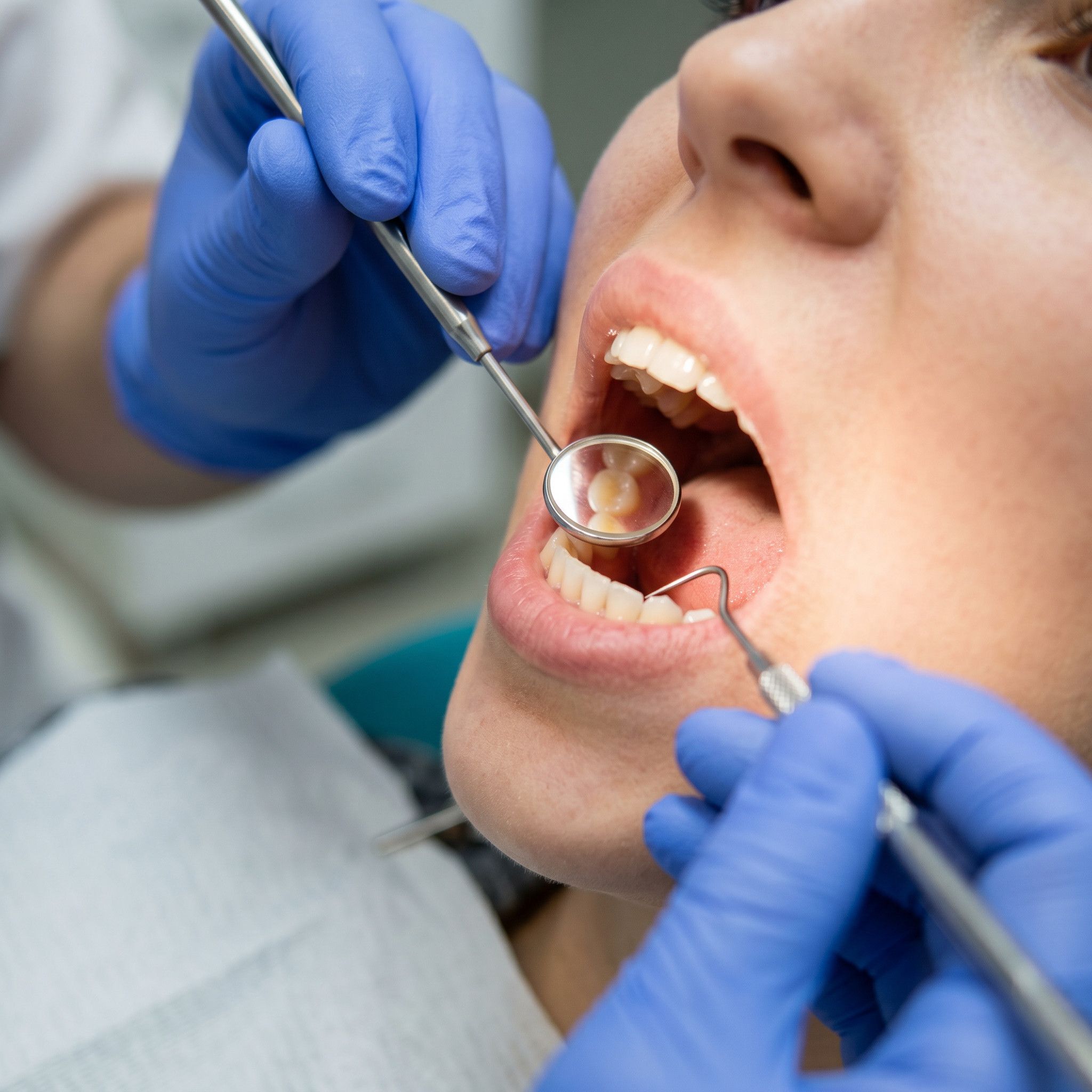 740: Podcast IA - Blanqueamiento dental casero: los errores que más daño causan al esmalte, según expertos episode artwork